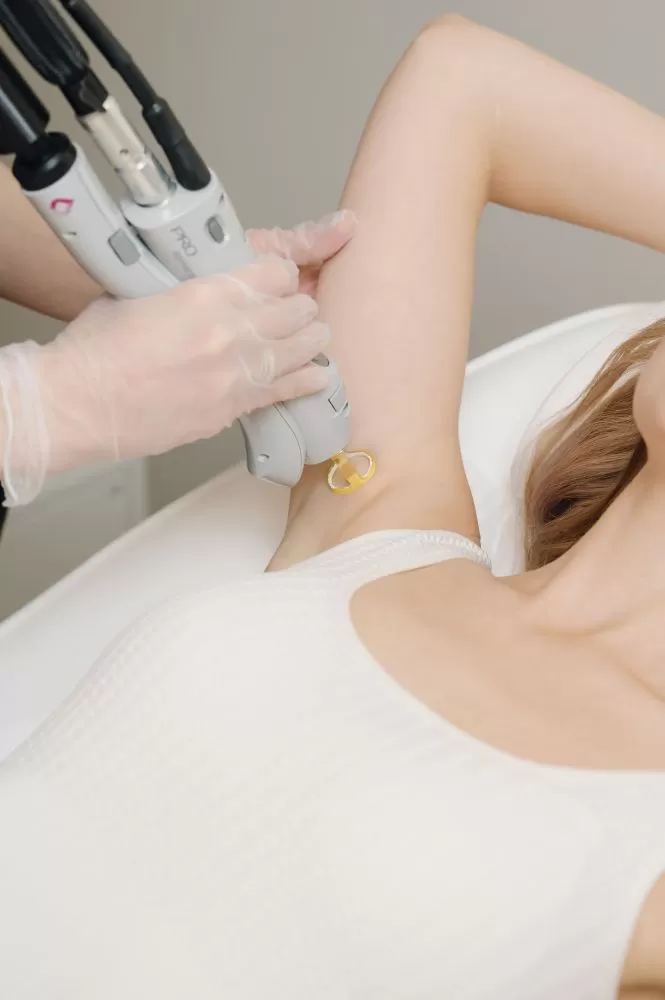 Лазерная эпиляция подмышек